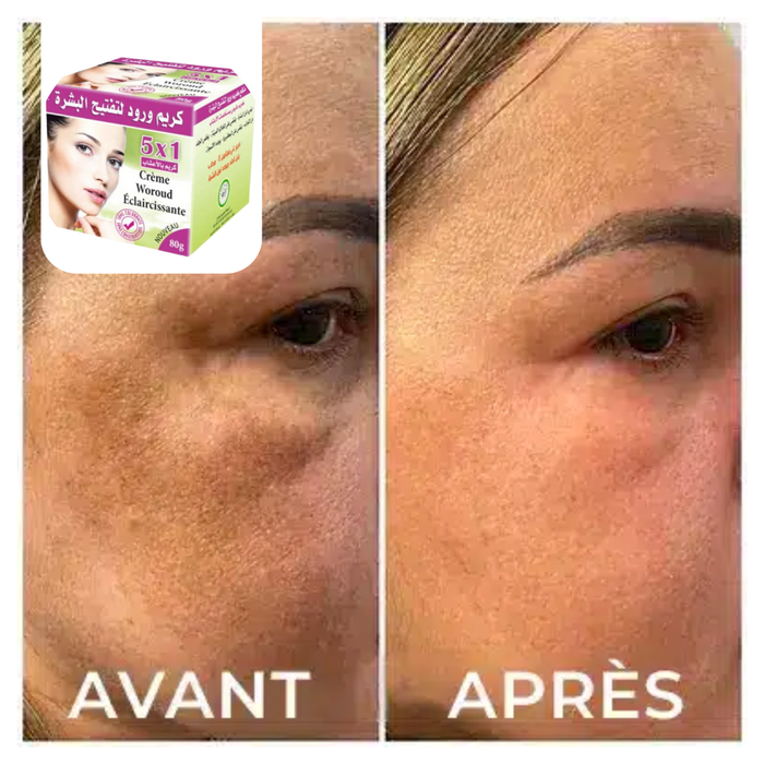 avant aprés Crème Woroud au rose Éclaircissante 80g | Teint Éclatant et Unifié