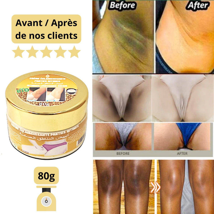 Crème blanchissante intime 80g | Éclaircissante| Antitache - nilabeautys.com