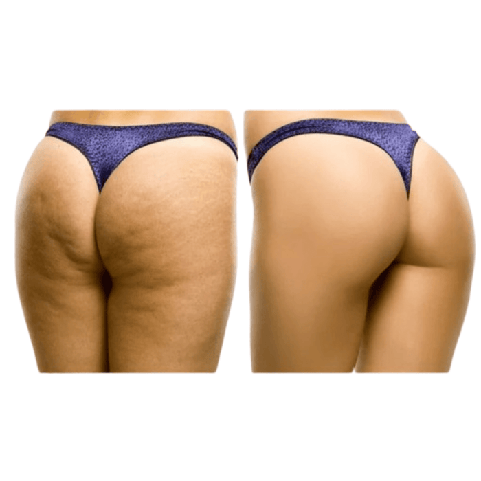 Pack Fessier Complet 5 produits - nilabeautys.com